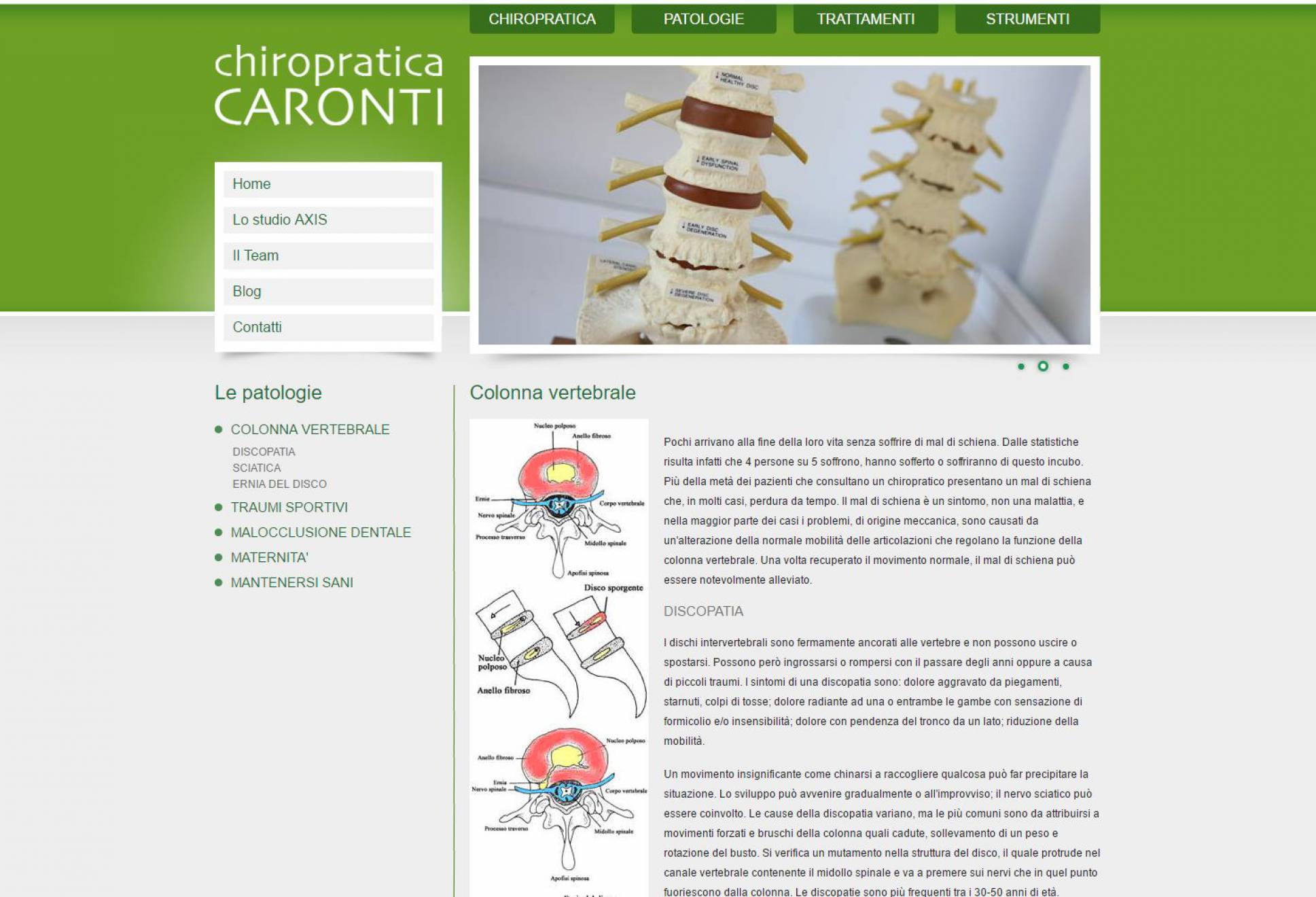 Sezione patologie sito internet Chiropratica Caronti